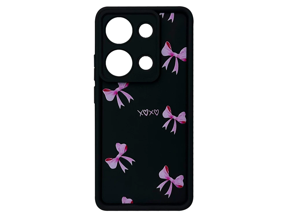 TPU Bows Xoxo Camera Redmi Note 13 Pro 4G/Poco M6 Pro 4G/Redmi Note 14S black